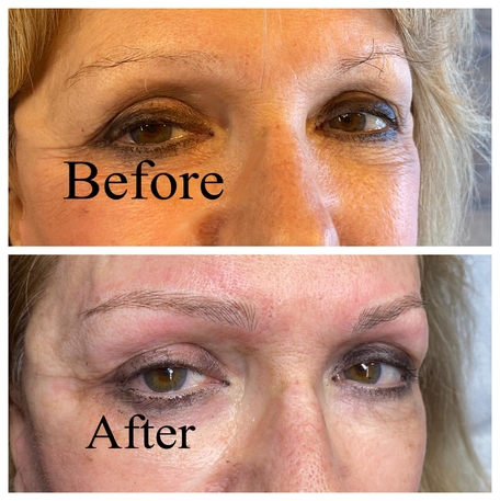 Microblading result 4